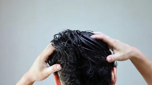 Solusi Efektif Mengatasi Rambut Rontok pada Pria: Kembalikan Kepercayaan Diri dengan Rambut Sehat