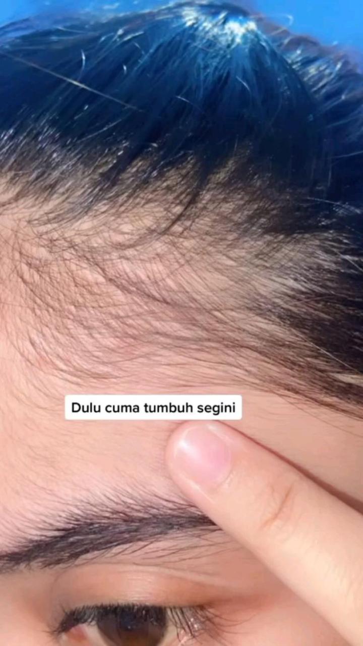 Beta-Karoten: Rahasia Rambut Sehat dan Berkilau