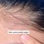 Rahasia Rambut Sehat dengan Minyak Thyme: Solusi Alami untuk Rambut Berkilau dan Sehat