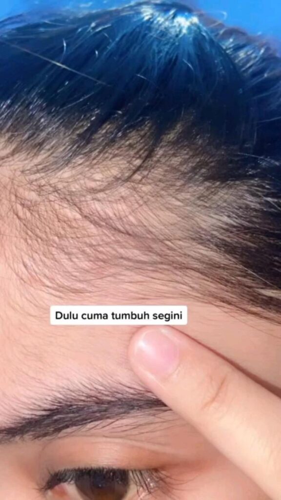 Rahasia Rambut Sehat dengan Minyak Thyme: Solusi Alami untuk Rambut Berkilau dan Sehat