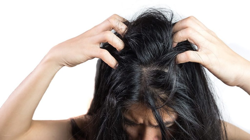 Cara Menghilangkan Ketombe pada Rambut Kering: 12 Tips Efektif untuk Hasil Maksimal