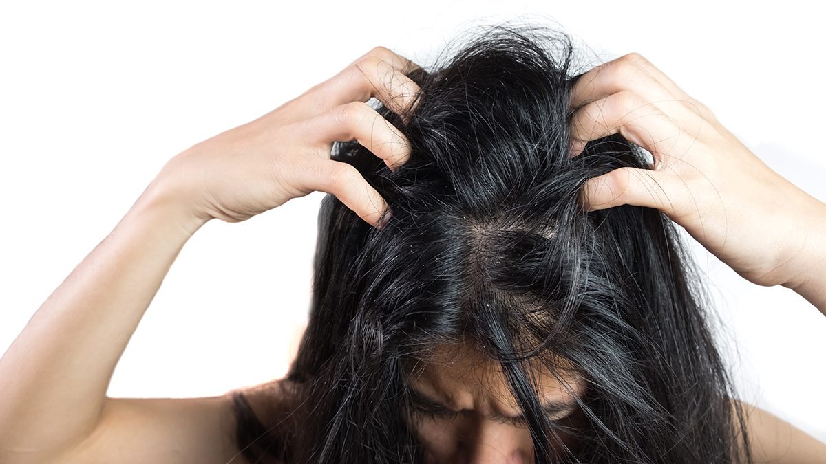 Rambut Rontok dan Ketombe: Penyebab yang Sering Tak Disadari