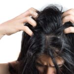 Cara Mengatasi Ketombe dan Rambut Berminyak: 12 Tips yang Wajib Dicoba