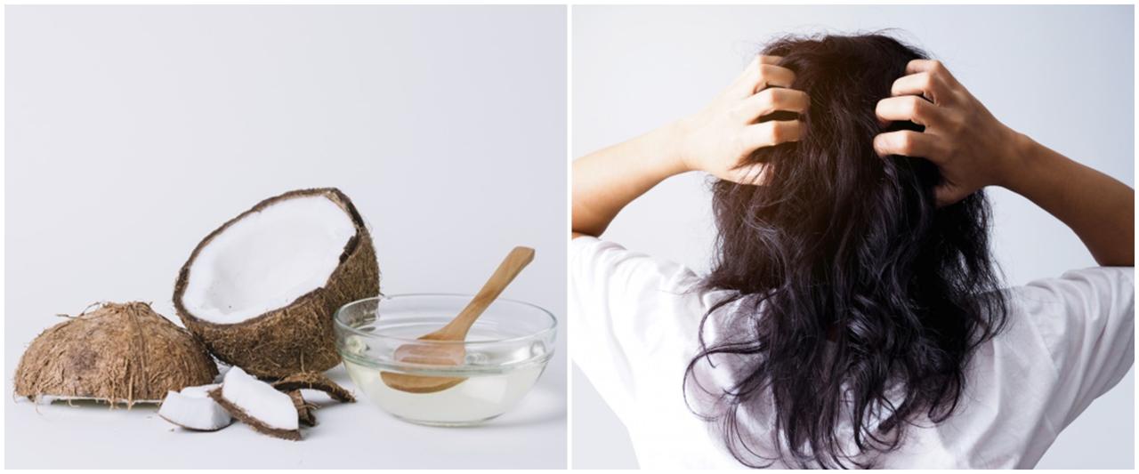 Rambut Kusut? Coba Atasi dengan Minyak Kelapa!