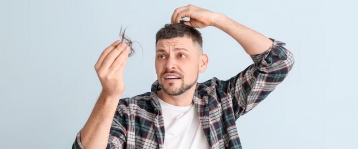 Rambut Rontok? Tenang, Masih Ada Harapan! Panduan Lengkap Mengatasi Rambut Rontok pada Pria