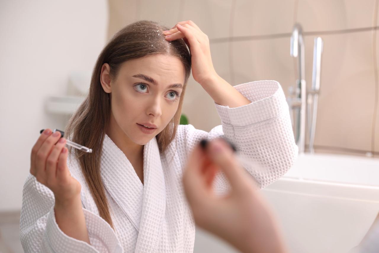 Gaya Rambut 2024: Tips Mengatasi Ketombe di Rambut Pendek