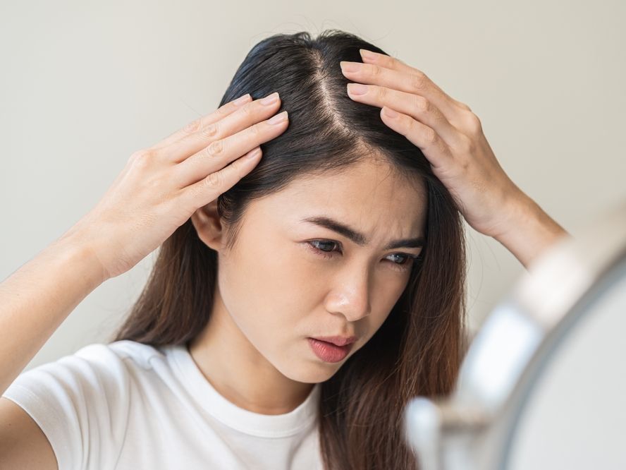 Mengapa Stres Bisa Menyebabkan Rambut Rontok? Ini Penyebab dan Solusinya!