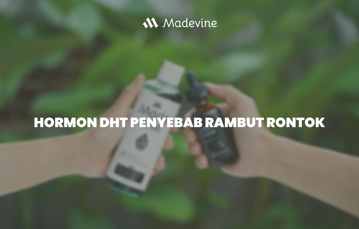 Bagaimana Hormon Memengaruhi Rambut Rontok? Ini Penjelasannya