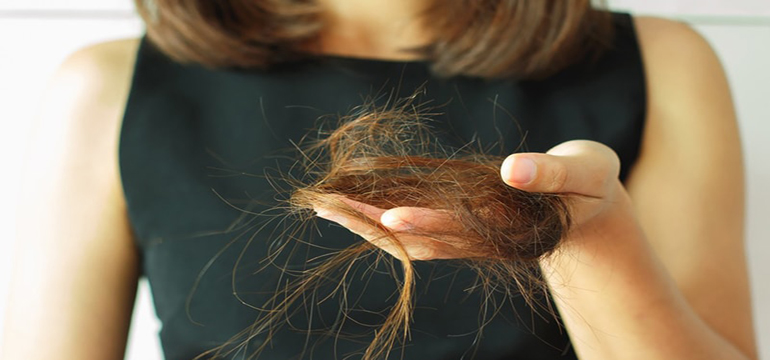 Rambut Rontok dan Ketombe: Penyebab yang Sering Tak Disadari