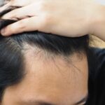 Mengapa Asam Folat Penting untuk Pertumbuhan Rambut? Rahasia Rambut Sehat dan Bercahaya!