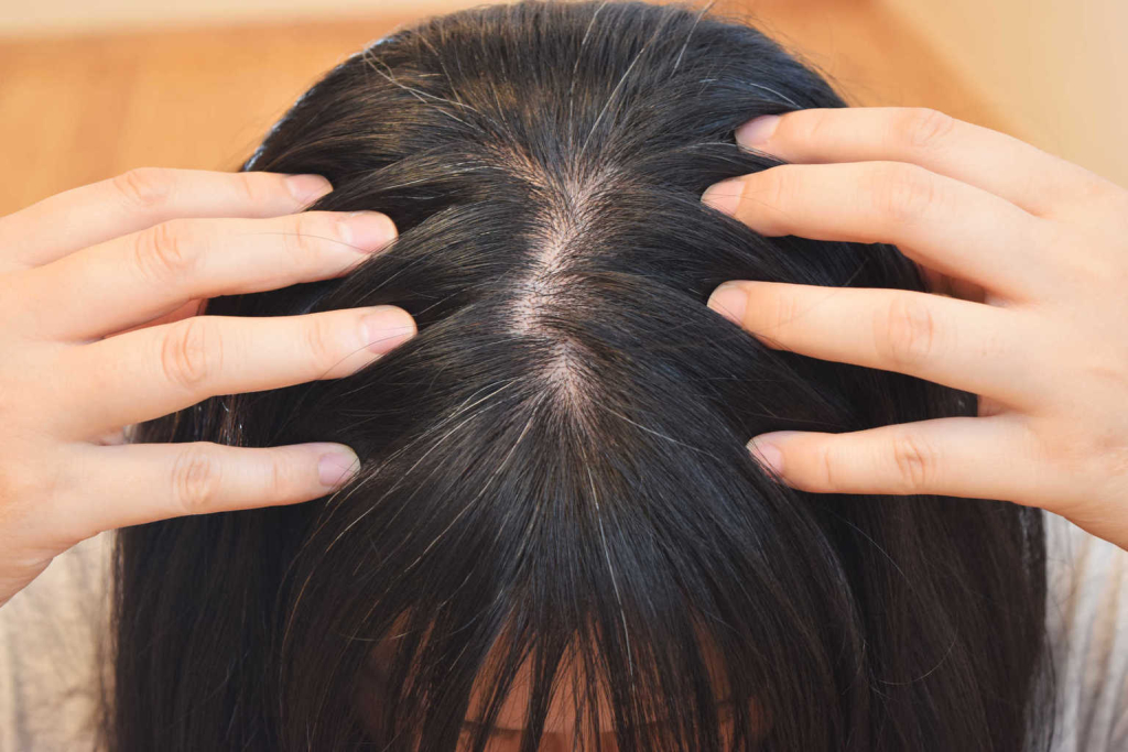 Apakah Rambut Lepek Bisa Dicegah dengan Produk Herbal?