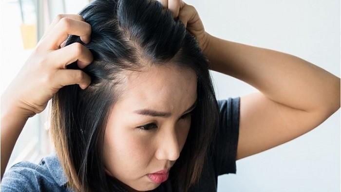 Apakah Rambut Mempengaruhi Jerawat?