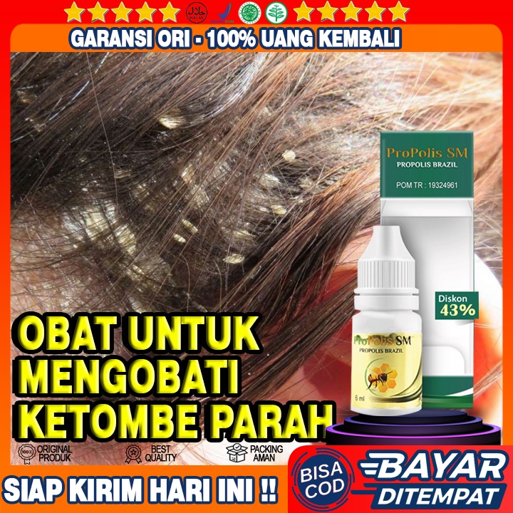 Selamat Tinggal Ketombe, Halo Rambut Sehat! Solusi Alami untuk Atasi Masalah Kulit Kepala