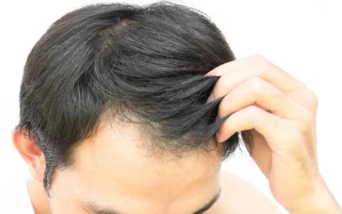 Rambut Rontok Setelah Operasi: Jangan Panik, Ini Solusinya!