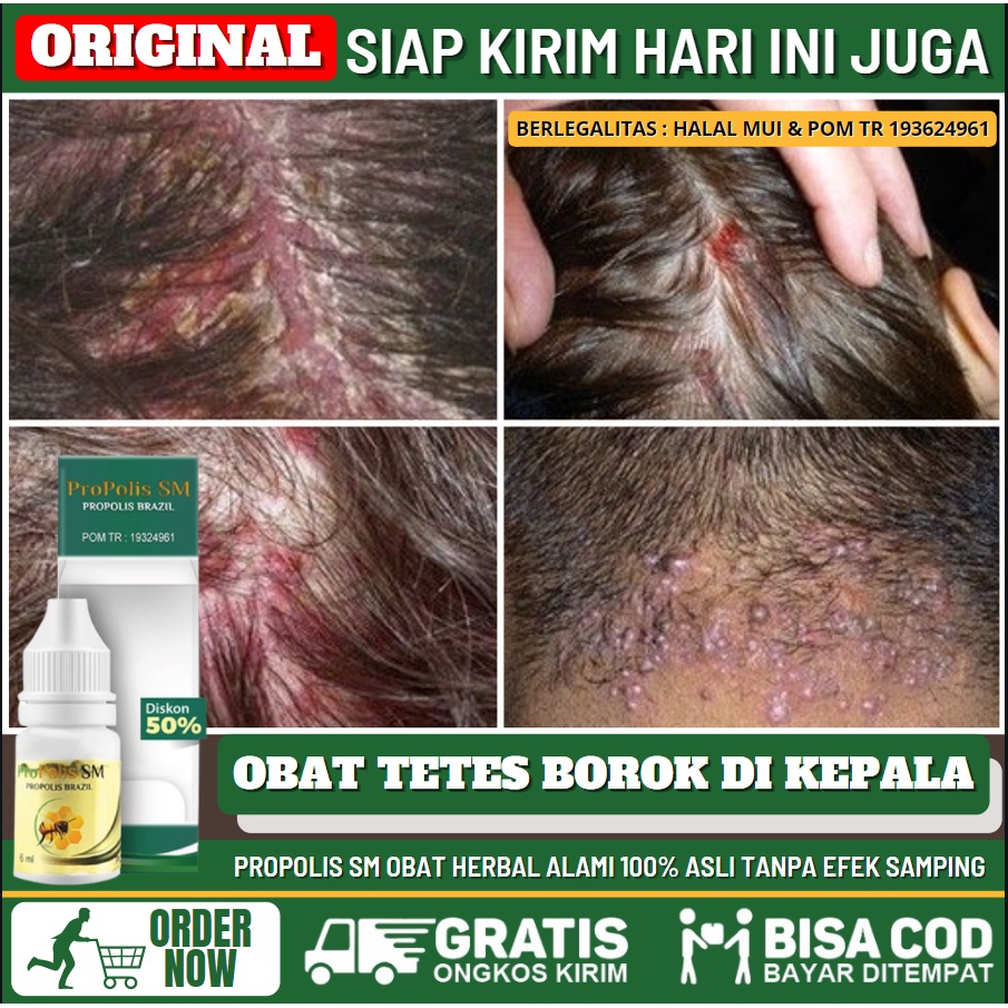 Kulit Kepala Gatal? Tenang, Ada Obat Alami yang Ampuh!