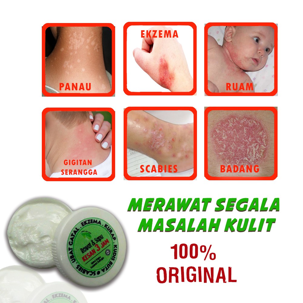 Gatal Tak Tertahankan di Kepala Si Kecil? Tenang, Ada Solusi Cepat dan Efektif!