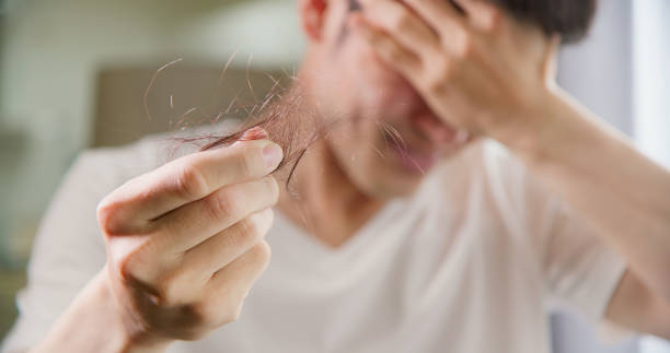 Rambut Rontok pada Pria: 12 Penyebab yang Perlu Anda Ketahui