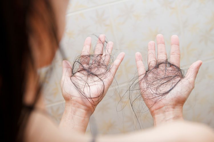 Rambut Rontok? Bisa Jadi Anda Kekurangan Besi!