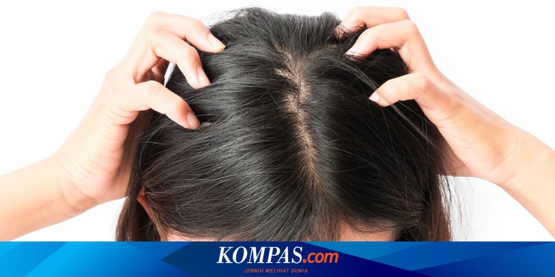 Gatal di Kulit Kepala Bikin Stres? Tenang, 12 Bahan Alami Ini Bisa Jadi Solusi!