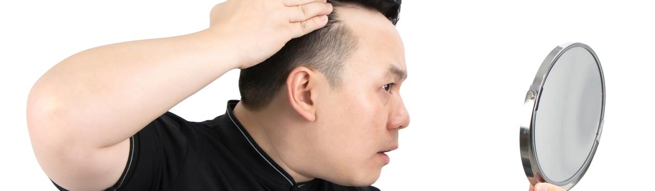 Gatal Tak Tertahankan, Rambut Rontok Tak Terhenti? Ini Penyebabnya dan Solusinya!