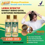 Selamat Tinggal Ketombe dan Kulit Kepala Gatal! Tips Ampuh untuk Mengatasinya dengan Cepat