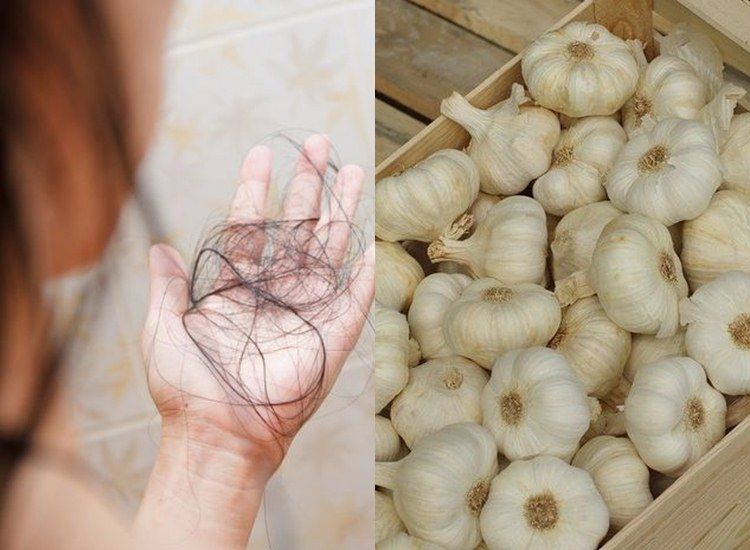 Rambut Rontok Bikin Kamu Kecewa? Tenang, Atasi Secara Alami dengan 7 Tips Ini!