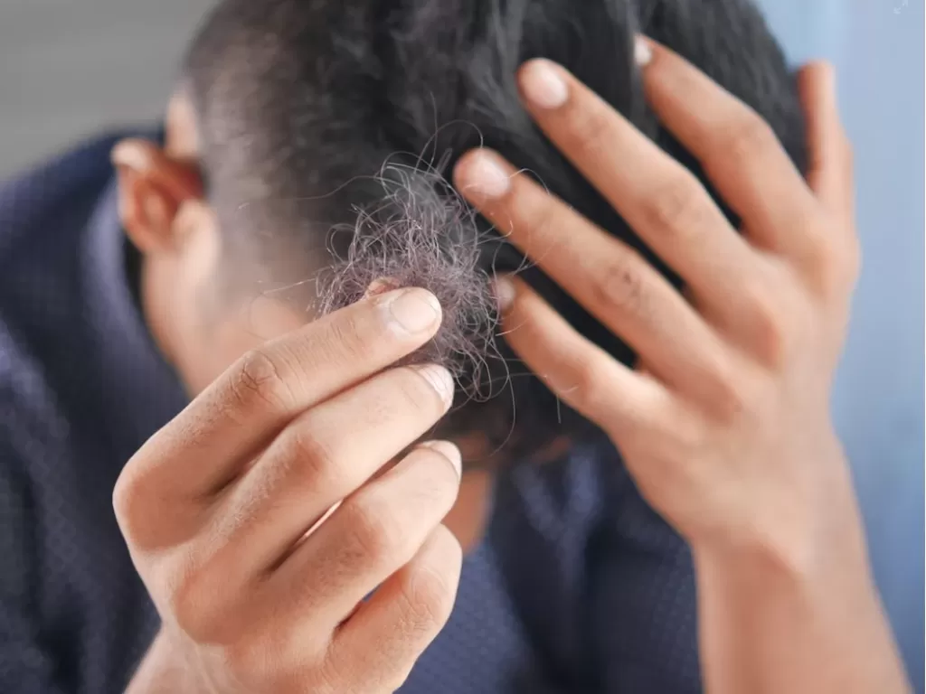 Rambut Rontok? Atasi Secara Alami dengan 7 Cara Ini!