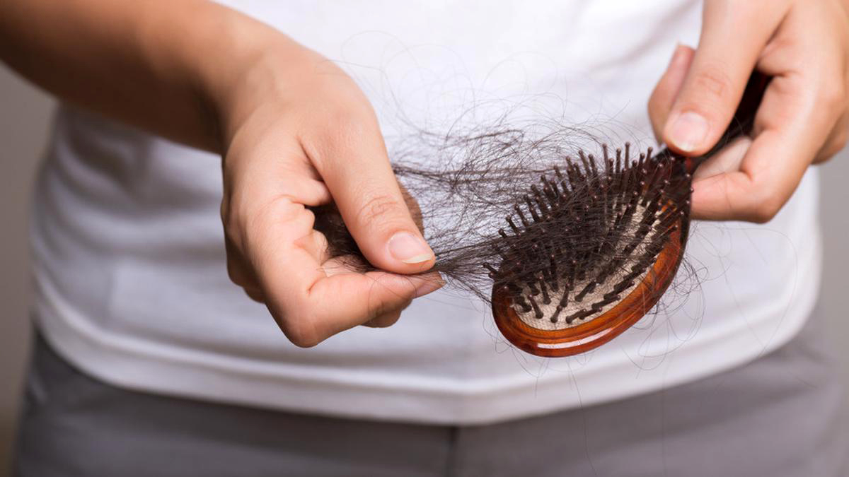 Mengapa Diet Bisa Menyebabkan Rambut Rontok? Ini Penyebab dan Solusinya