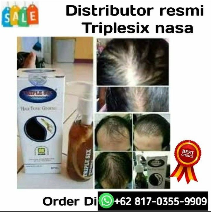 Yogurt: Rahasia Rambut Halus dan Lembut Alami