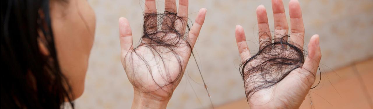 Ketombe dan Rambut Rontok: 12 Faktor yang Harus Diwaspadai!