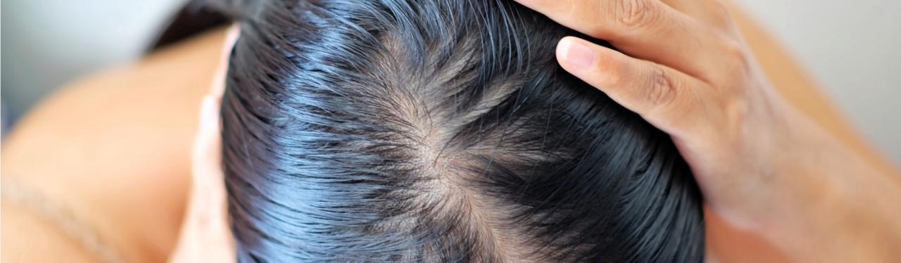 Mengapa Rambut Lepek Setelah Berkeringat? Rahasia di Balik Rambut yang Tak Bernyawa