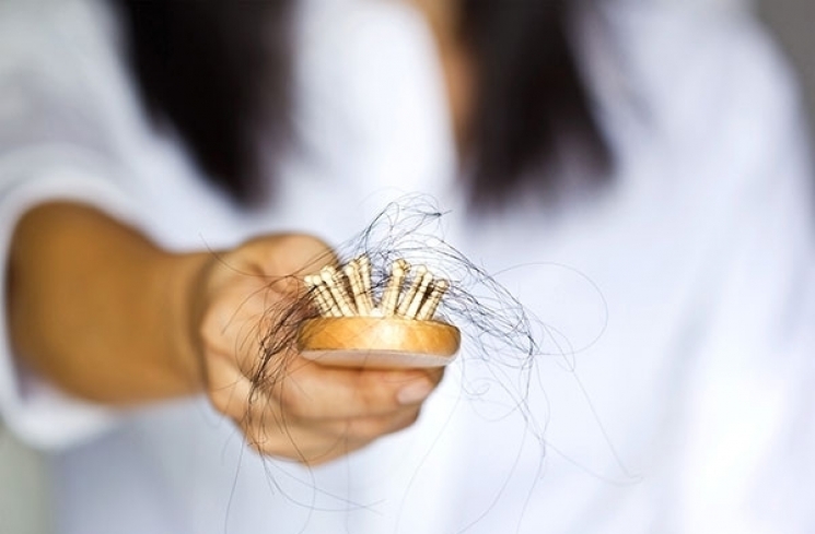 Rambut Rontok dan Patah? Atasi dengan Cara yang Tepat!