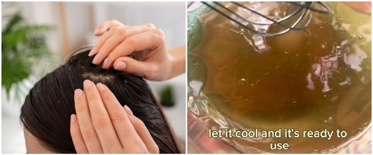 Rambut Rontok dan Lemah? Atasi Infeksi Kulit Kepala dan Jaga Keindahan Rambutmu!