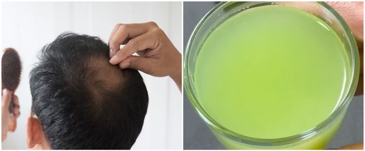 8 Nutrisi yang Efektif untuk Mengatasi Rambut Tipis: Rahasia Rambut Lebat dan Sehat