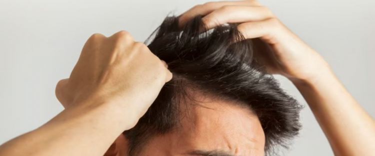 Rahasia Mengatasi Rambut Patah dan Rapuh yang Jarang Diketahui