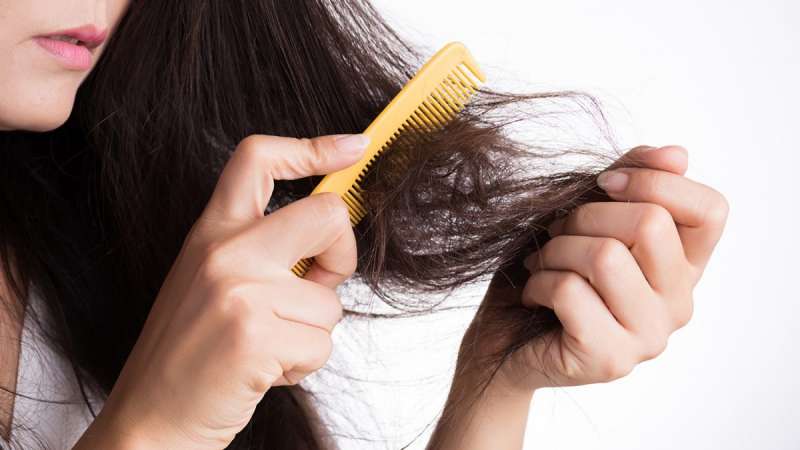 Rambut Rontok Bikin Stres? Tenang, Ini Cara Efektif Mengatasinya!