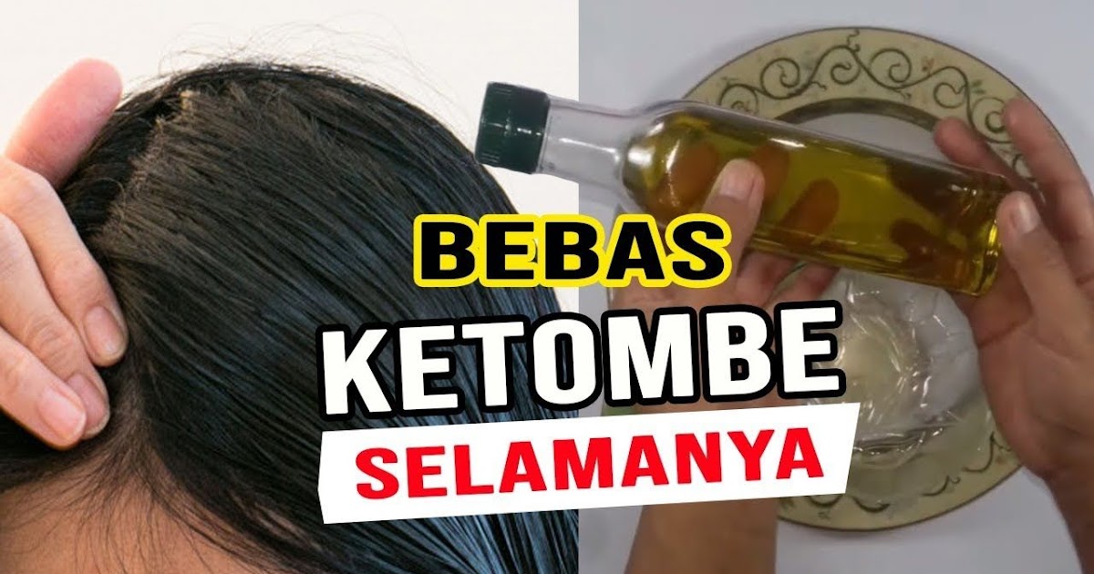 Mengapa Ketombe Bisa Basah dan Kering Sekaligus? Misteri Kulit Kepala yang Mengganggu!