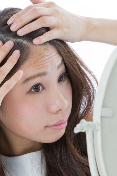 Cara Mengatasi Ketombe dan Rambut Berminyak: 12 Tips yang Wajib Dicoba