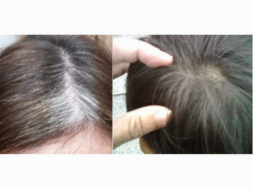 Mengapa Rambutmu Beruban? Rahasia Mengatasi Uban dan Menjaga Rambut Tetap Sehat