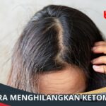 Cara Menghilangkan Ketombe pada Rambut Keriting: 12 Tips untuk Rambut Sehat dan Bebas Ketombe