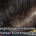 Perangi Gatal dan Ketombe: Panduan Lengkap Menyelamatkan Kulit Kepala Anda