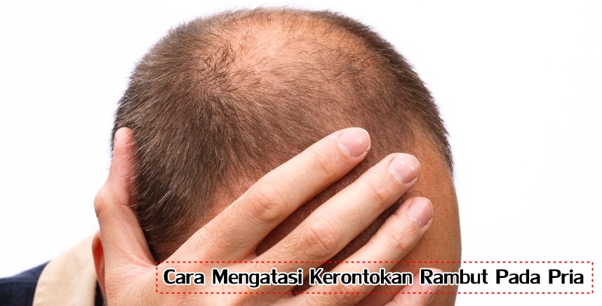 Solusi Praktis Mengatasi Rambut Kusut pada Pria: Taklukkan Kekacauan di Atas Kepala!