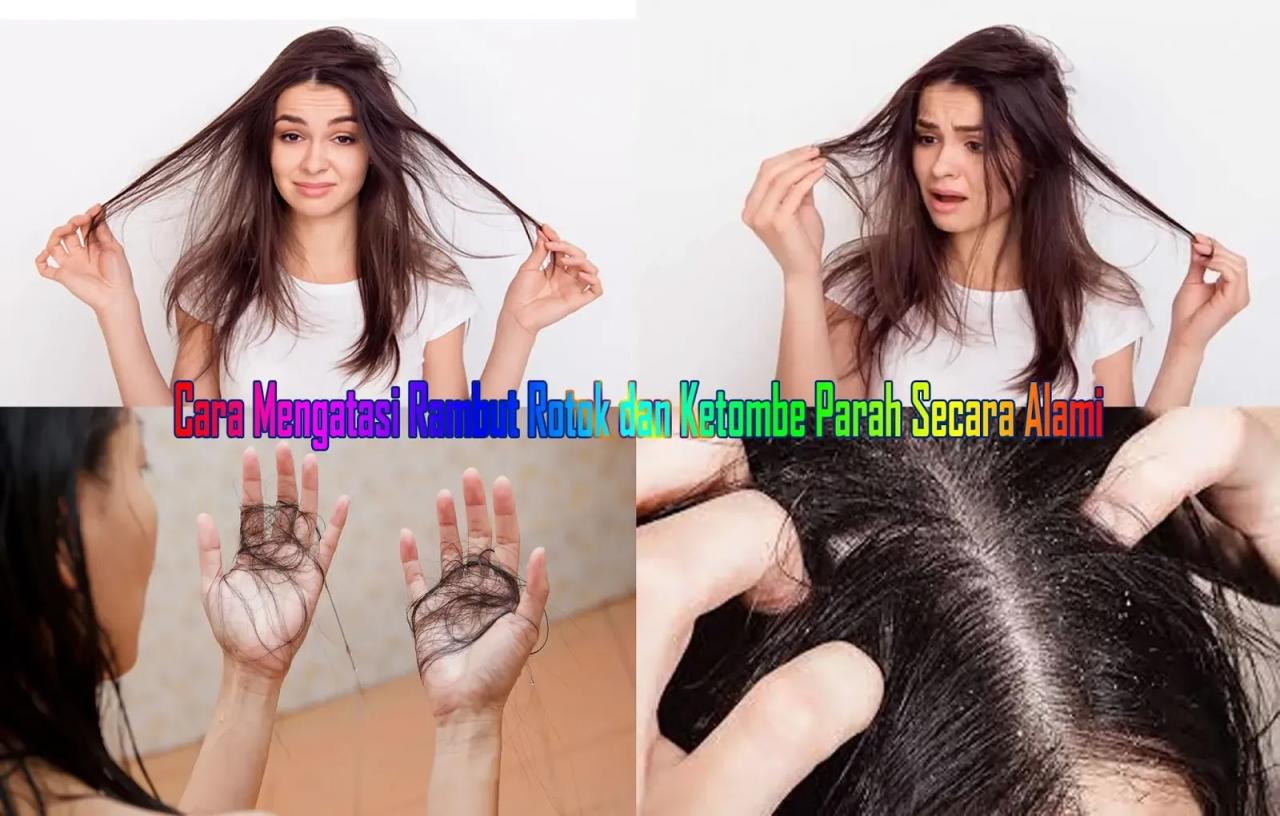 Rambut Rontok Parah? Jangan Panik! Simak Cara Mengatasinya di Sini