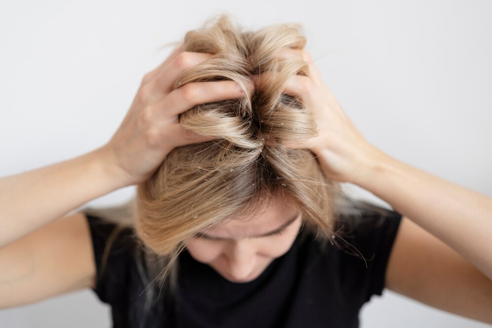 Rambut Mengembang dan Susah Diatur? Tenang, Ada Solusinya!