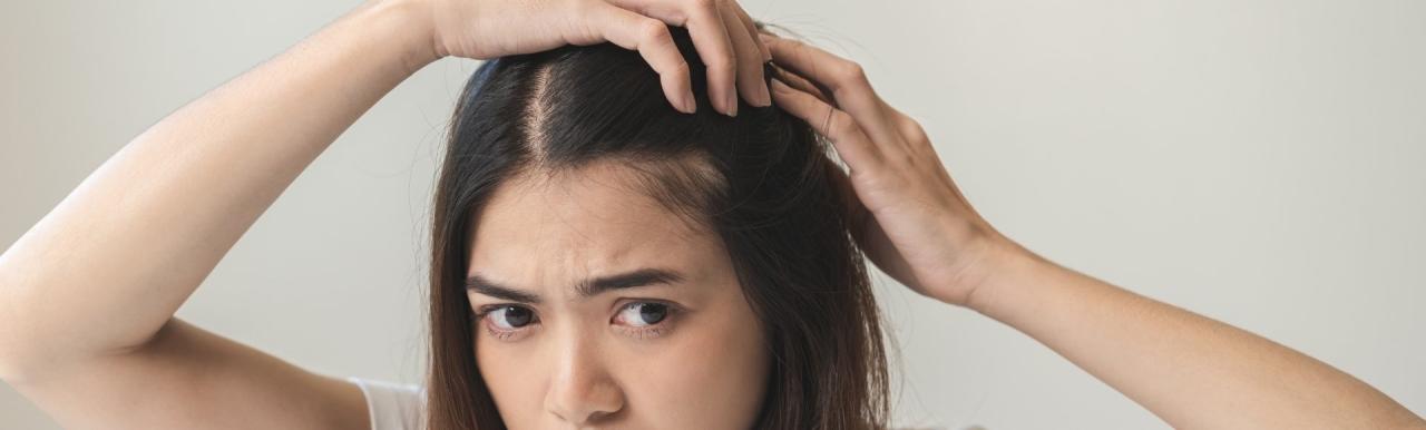 Cara Mengatasi Ketombe Kering pada Rambut: 12 Langkah untuk Kulit Kepala Sehat