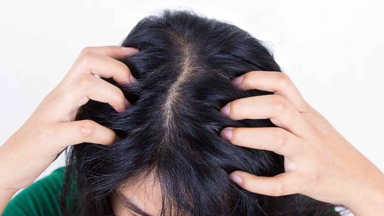 Cara Mengatasi Kulit Kepala Gatal dan Kering: 12 Langkah untuk Kesehatan Rambut