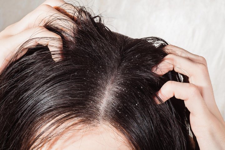 Ucapkan Selamat Tinggal pada Rambut Kusam! Rahasia Awet Muda dengan Bahan Alami