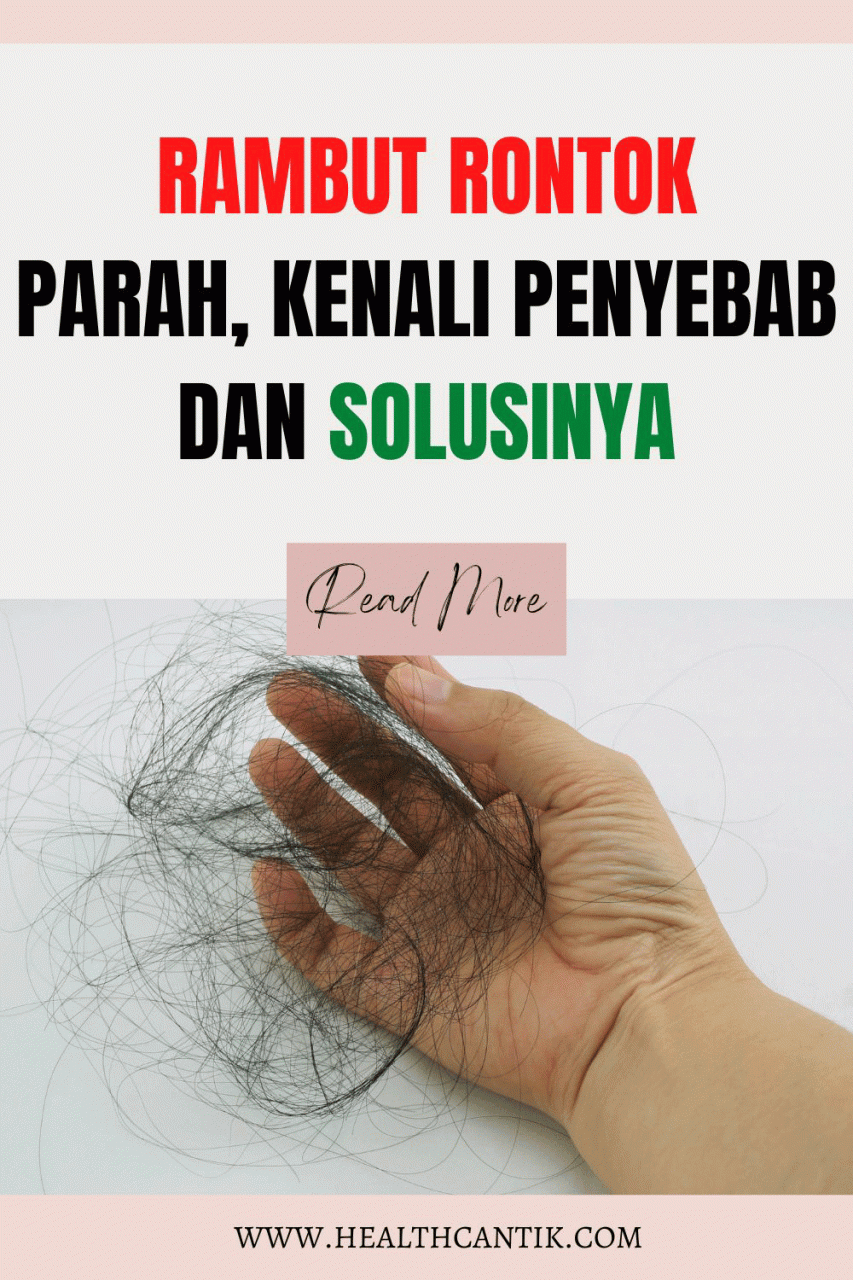 Rambut Rontok Parah? Tenang, Ada Solusinya!