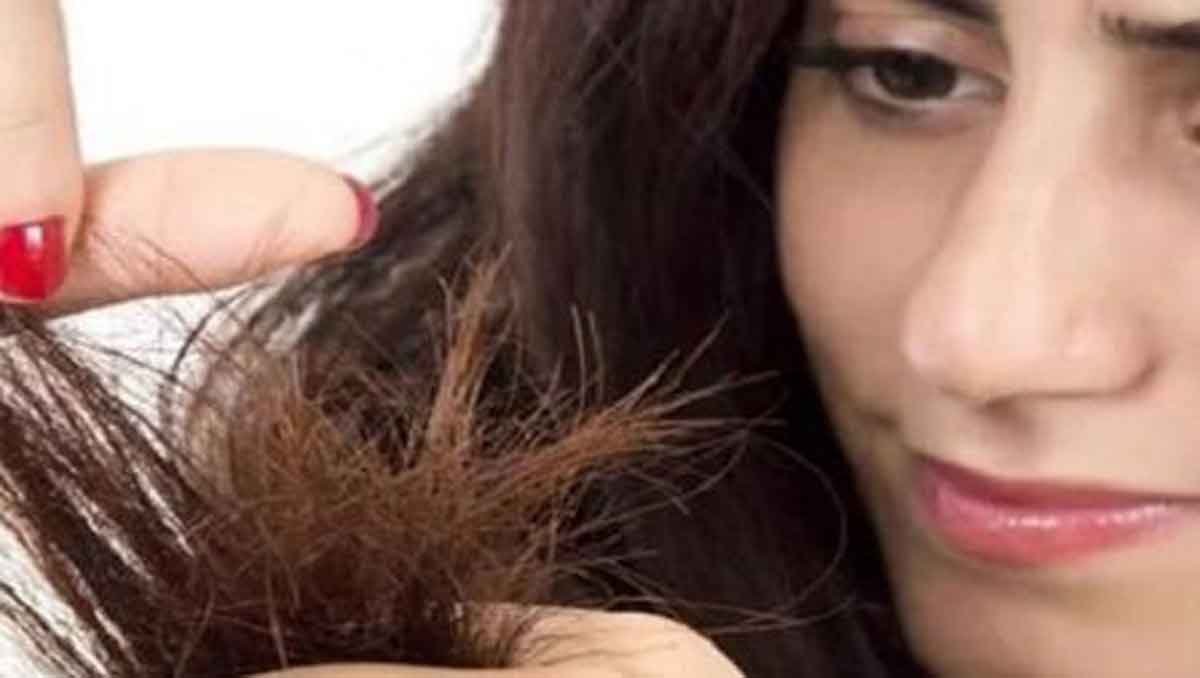 Rambut Bercabang? Atasi dengan Vitamin Ini!