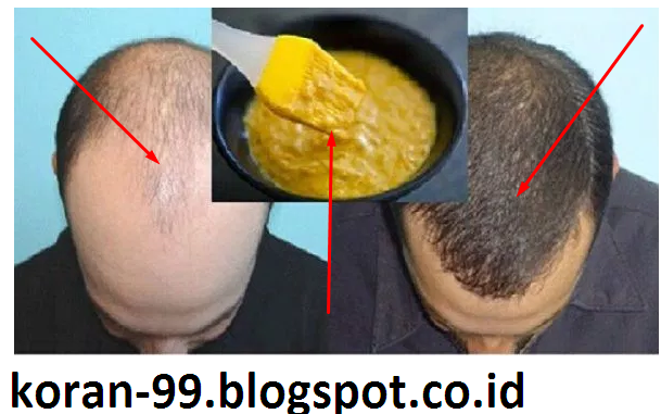 Rambut Patah? Tenang, Ada Solusinya!